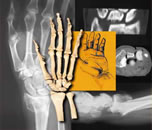 xray